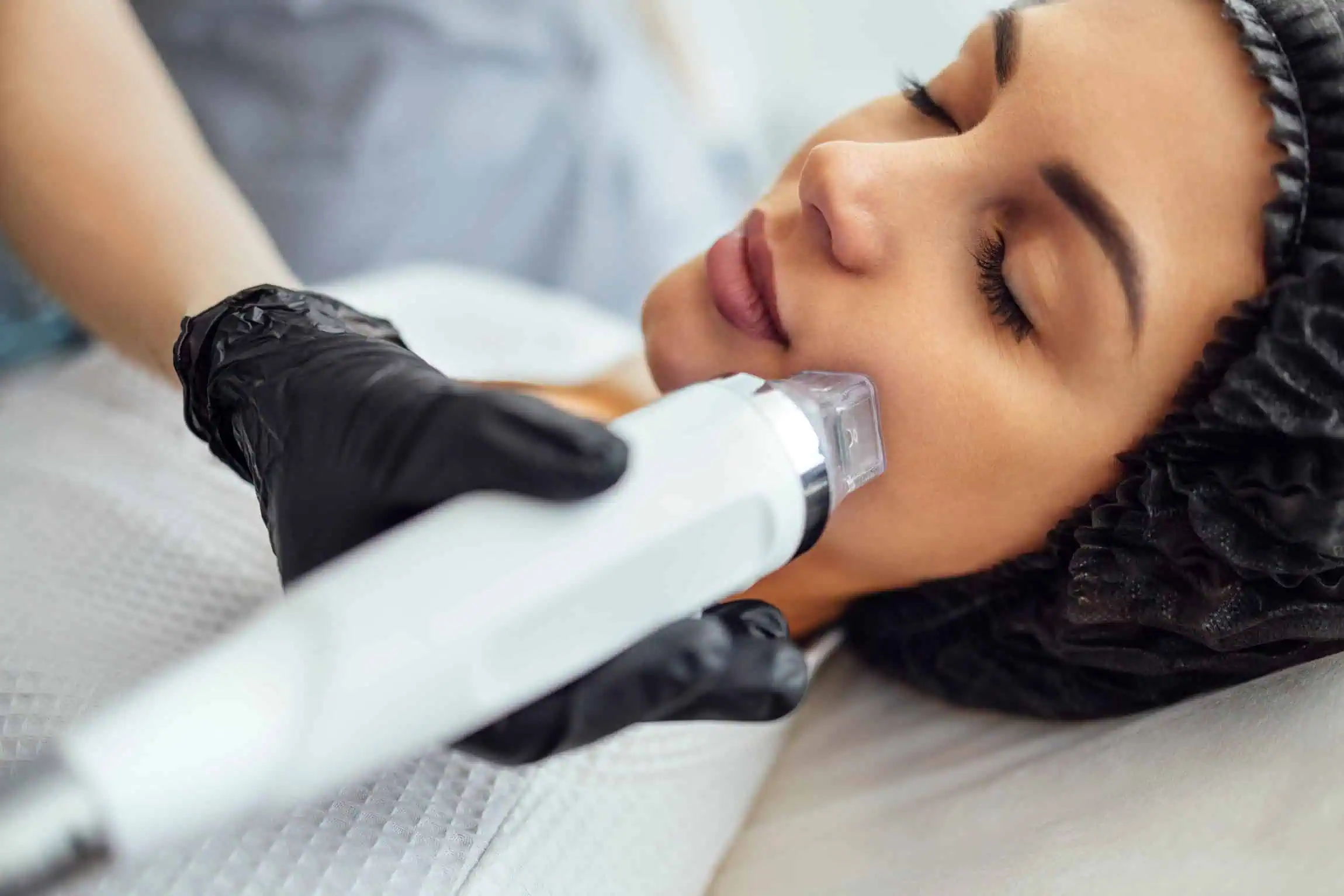 rf-microneedling-in-idaho-falls-id | Evara aesthetics