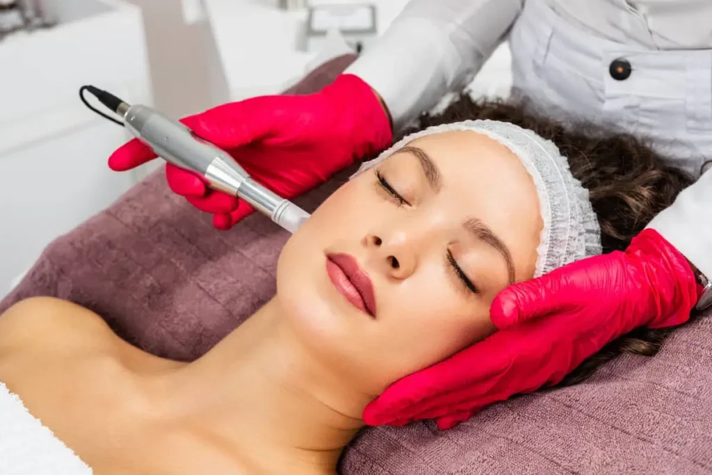 RF Microneedling by Bella Jade Medspa in Idaho Falls