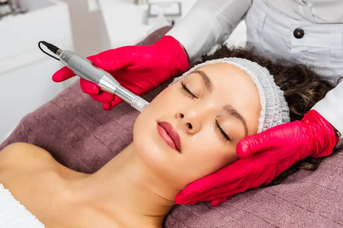 RF Microneedling by Bella Jade Medspa in Idaho Falls